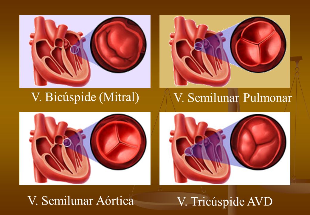 V. Bicúspide (Mitral) V. Semilunar Pulmonar V. Semilunar Aórtica V. Tricúspide AVD
