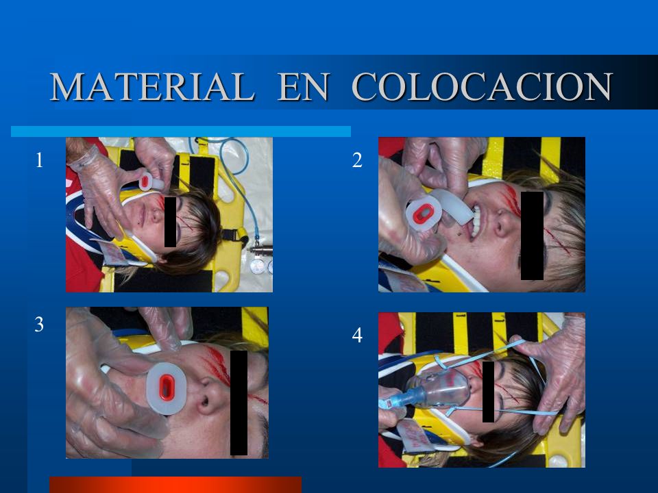 MATERIAL EN COLOCACION
