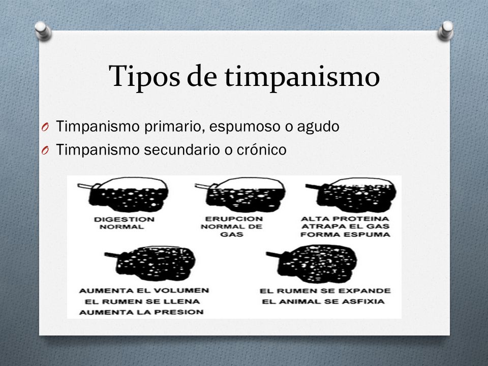 Tipos de timpanismo Timpanismo primario, espumoso o agudo
