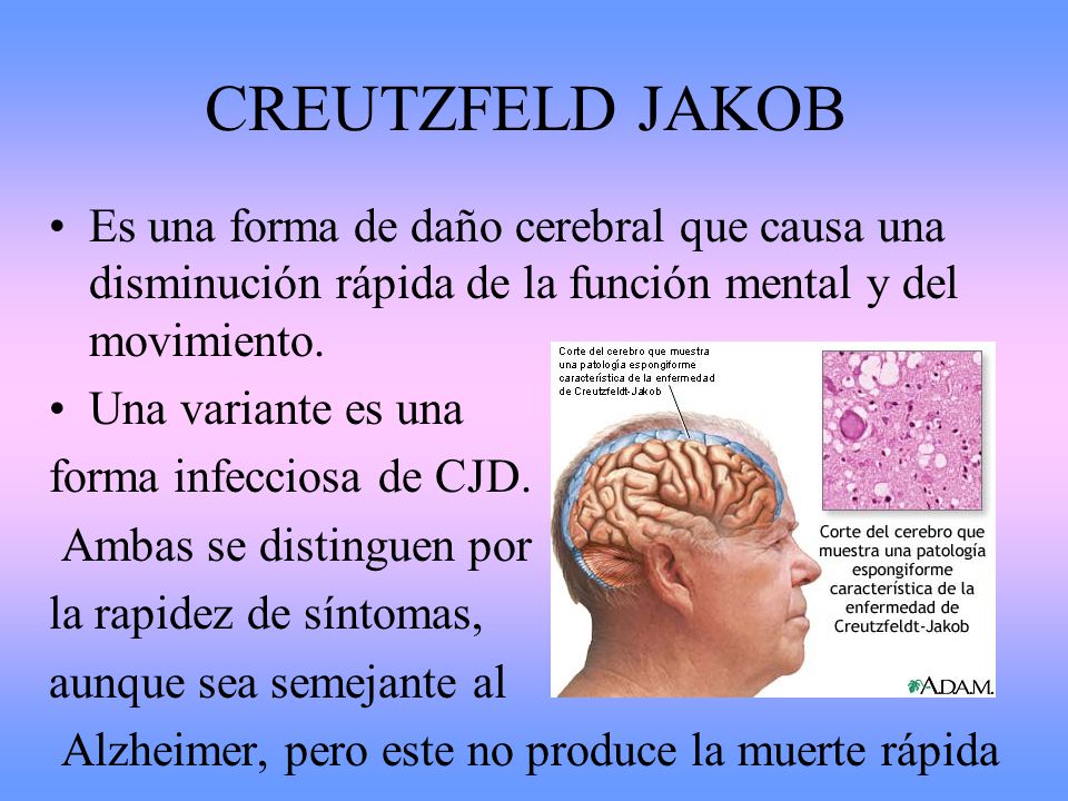 CREUTZFELD JAKOB Es una forma de daño cerebral que causa una disminución rápida de la función mental y del movimiento.