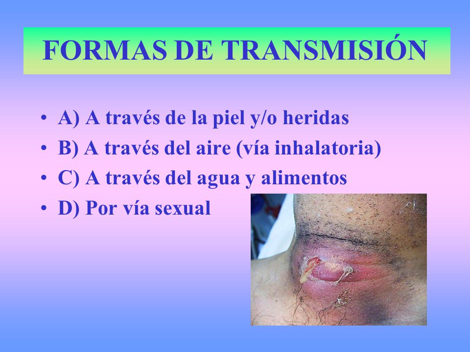 FORMAS DE TRANSMISIÓN A) A través de la piel y/o heridas