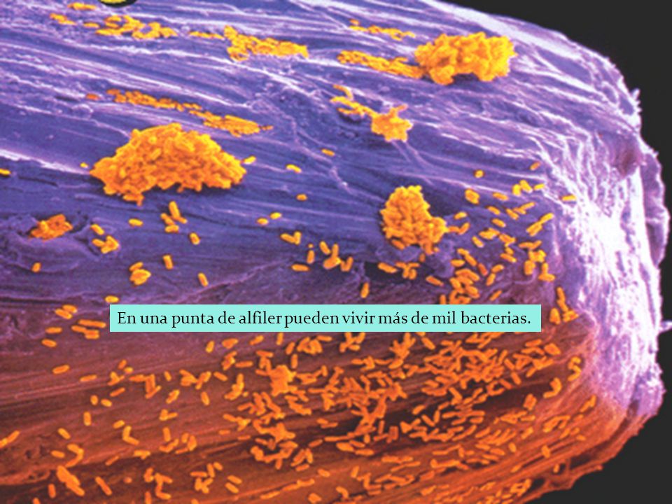 En una punta de alfiler pueden vivir más de mil bacterias.