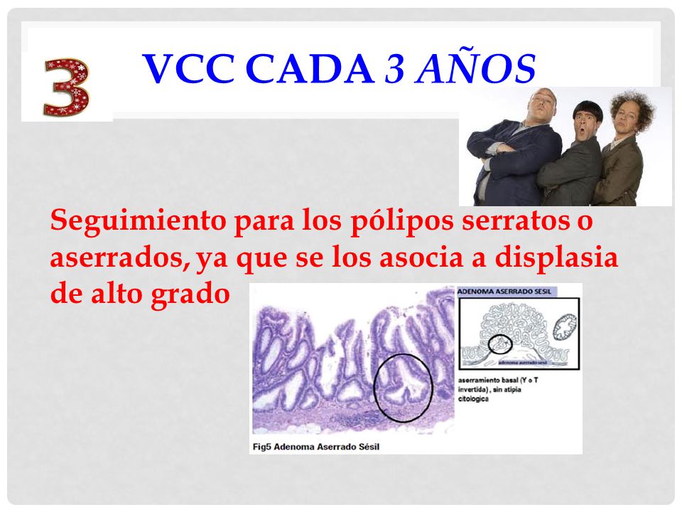 VCC CADA 3 AÑOS Seguimiento para los pólipos serratos o aserrados, ya que se los asocia a displasia de alto grado.