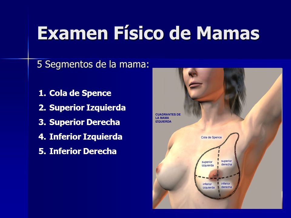 Examen Físico de Mamas 5 Segmentos de la mama: Cola de Spence