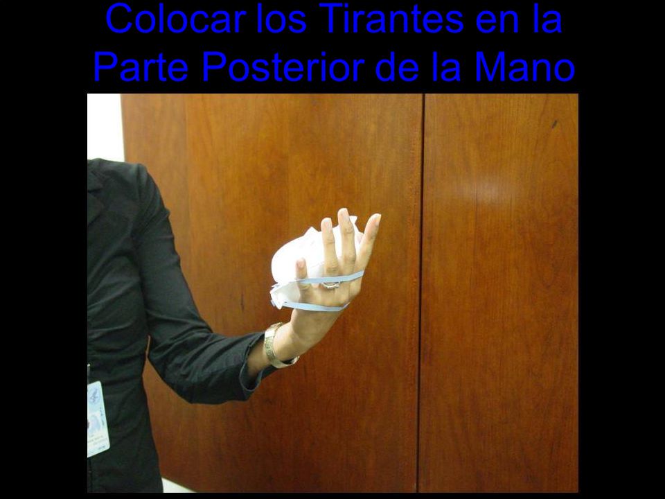 Colocar los Tirantes en la Parte Posterior de la Mano