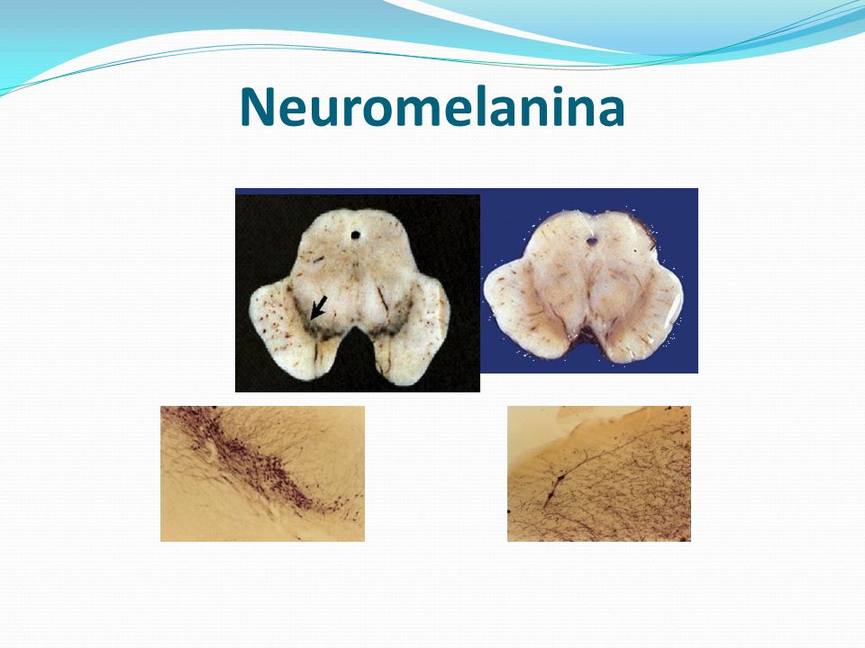 Neuromelanina