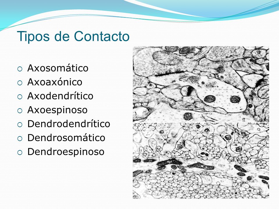 Tipos de Contacto Axosomático Axoaxónico Axodendrítico Axoespinoso