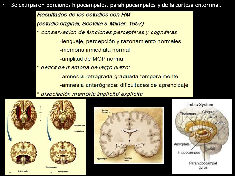 Se extirparon porciones hipocampales, parahipocampales y de la corteza entorrinal.