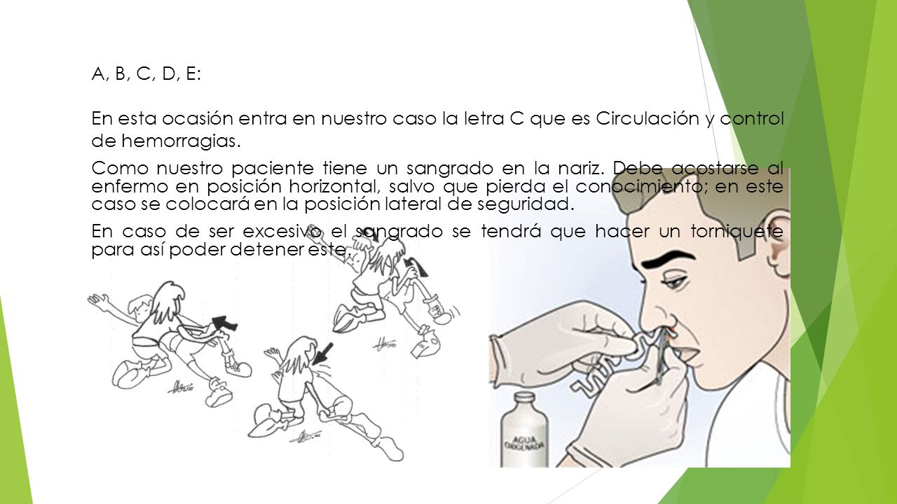 A, B, C, D, E: En esta ocasión entra en nuestro caso la letra C que es Circulación y control de hemorragias.