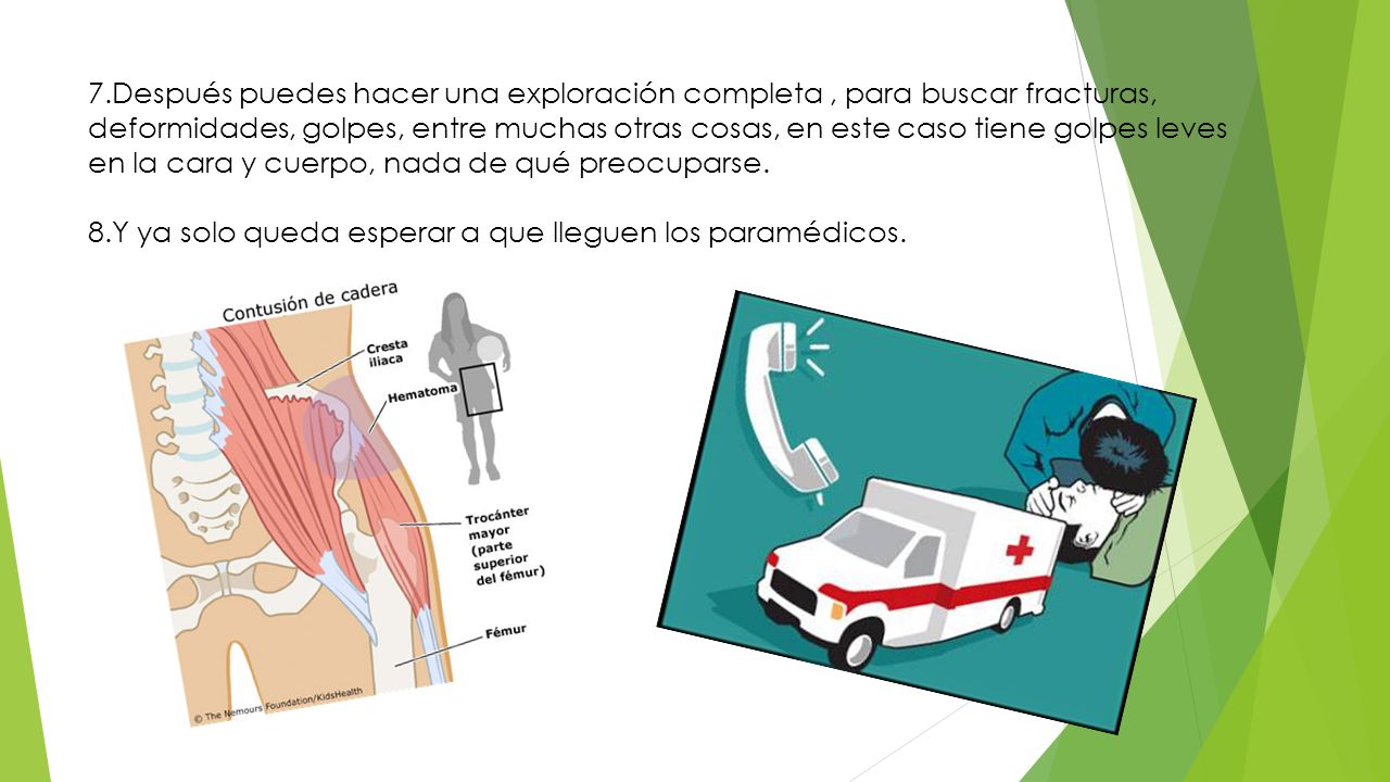 7.Después puedes hacer una exploración completa , para buscar fracturas, deformidades, golpes, entre muchas otras cosas, en este caso tiene golpes leves en la cara y cuerpo, nada de qué preocuparse.