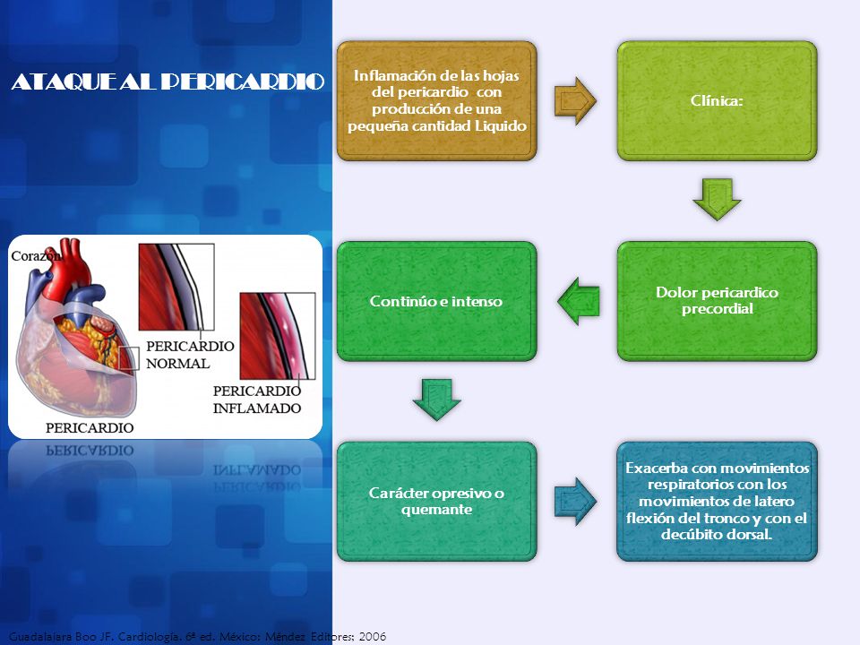 Dolor pericardico precordial Carácter opresivo o quemante