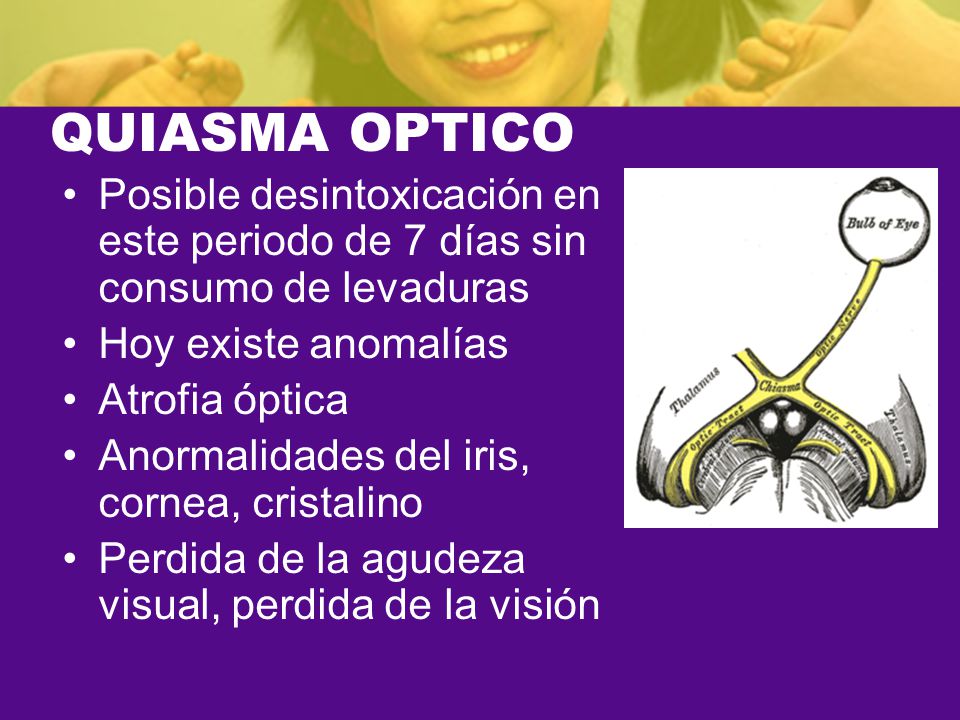 QUIASMA OPTICO Posible desintoxicación en este periodo de 7 días sin consumo de levaduras. Hoy existe anomalías.