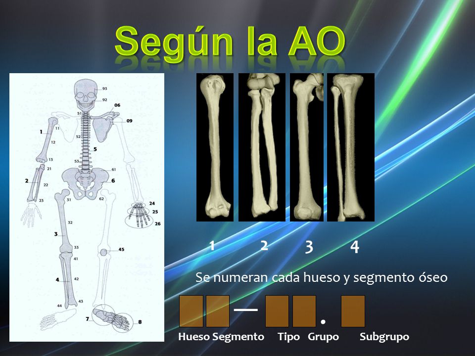 Según la AO . — Se numeran cada hueso y segmento óseo