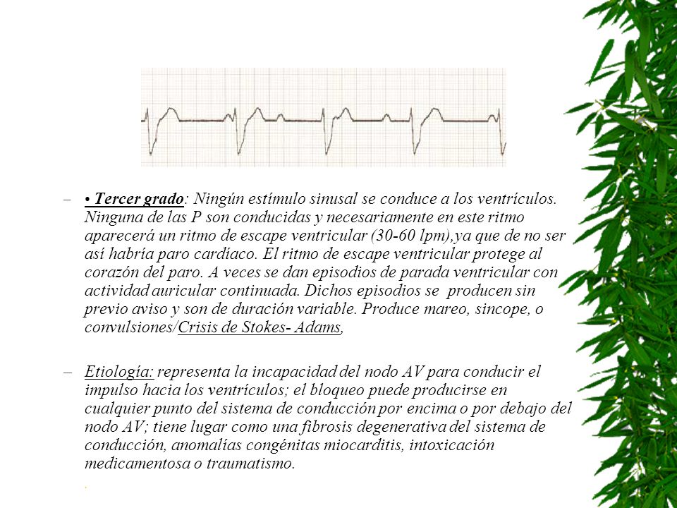 • Tercer grado: Ningún estímulo sinusal se conduce a los ventrículos