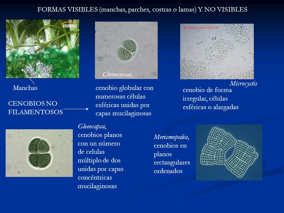 FORMAS VISIBLES (manchas, parches, costras o lamas) Y NO VISIBLES