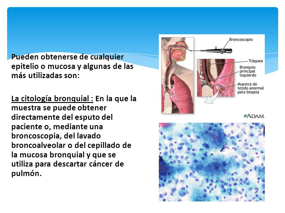 Pueden obtenerse de cualquier epitelio o mucosa y algunas de las más utilizadas son: