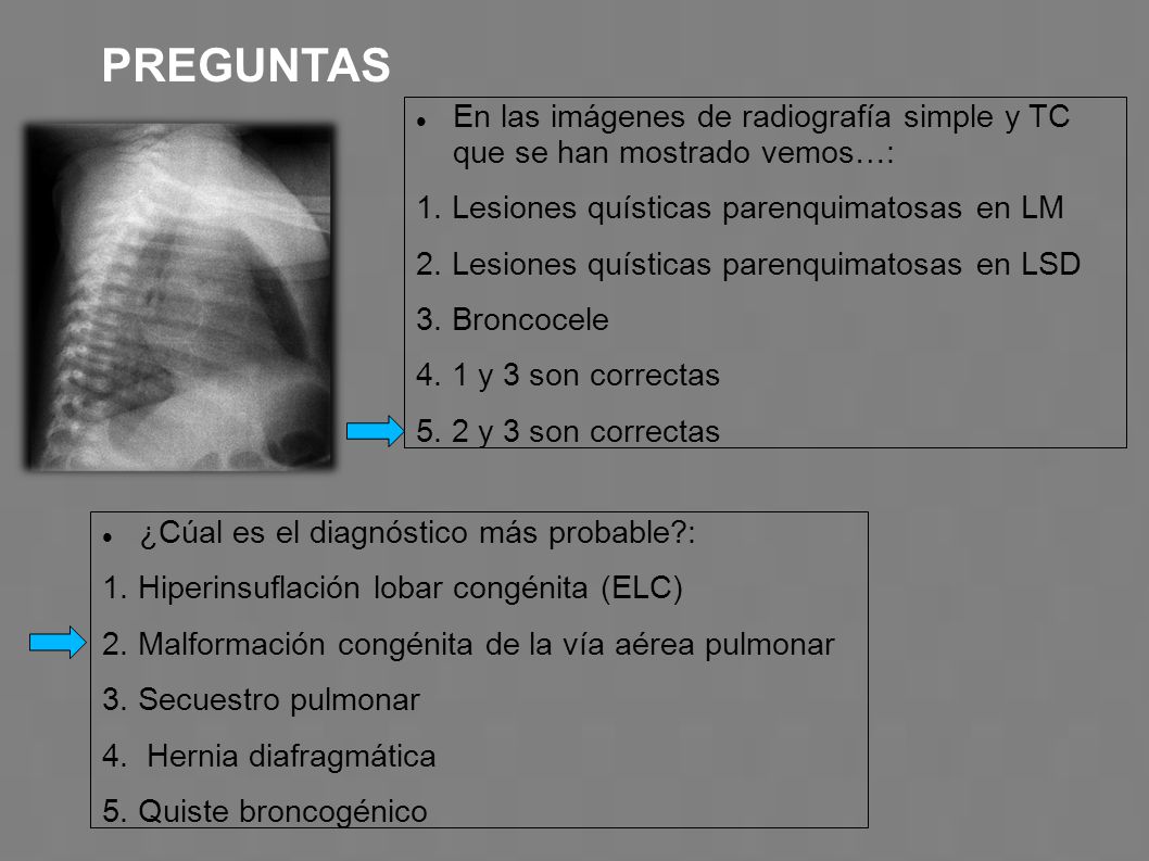 PREGUNTAS En las imágenes de radiografía simple y TC que se han mostrado vemos…: 1. Lesiones quísticas parenquimatosas en LM.