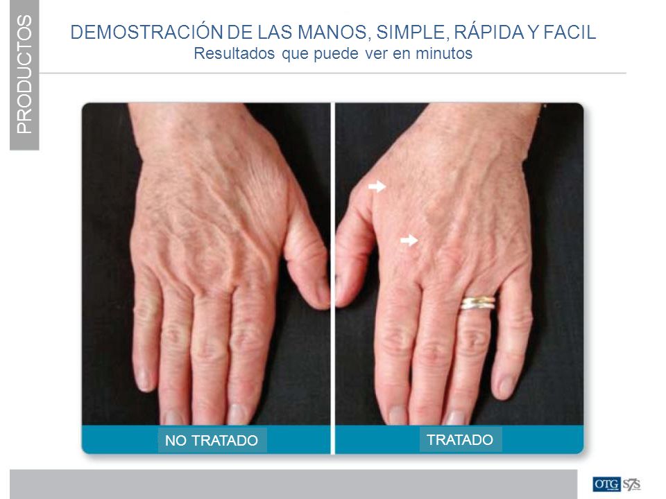 DEMOSTRACIÓN DE LAS MANOS, SIMPLE, RÁPIDA Y FACIL PRODUCTOS