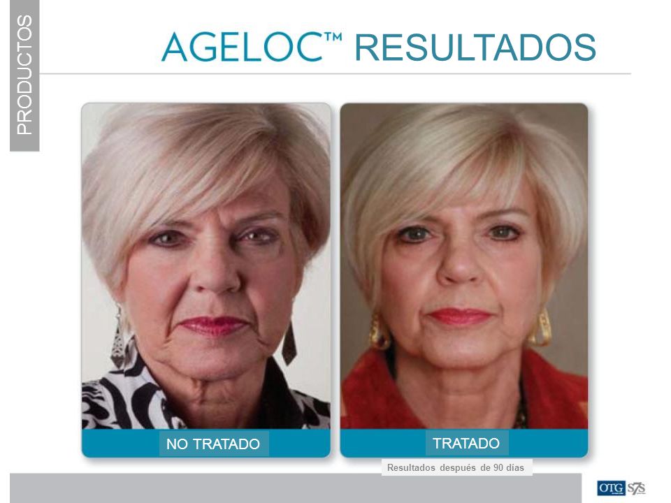 RESULTADOS PRODUCTOS NO TRATADO TRATADO Resultados después de 90 días