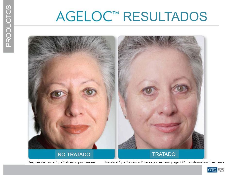 RESULTADOS PRODUCTOS NO TRATADO TRATADO