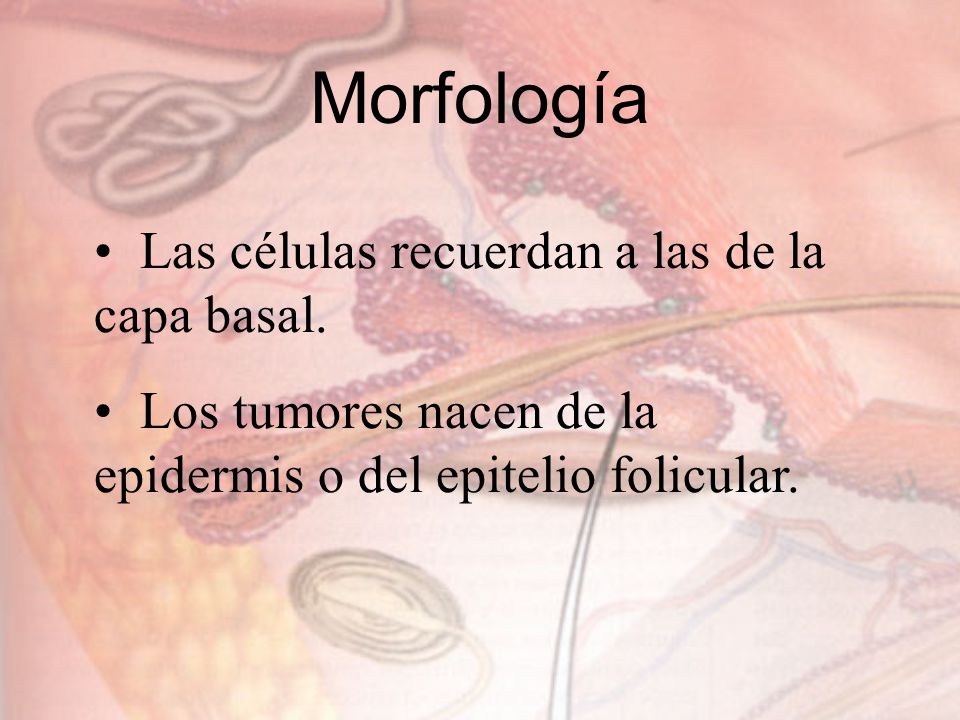 Morfología Las células recuerdan a las de la capa basal.