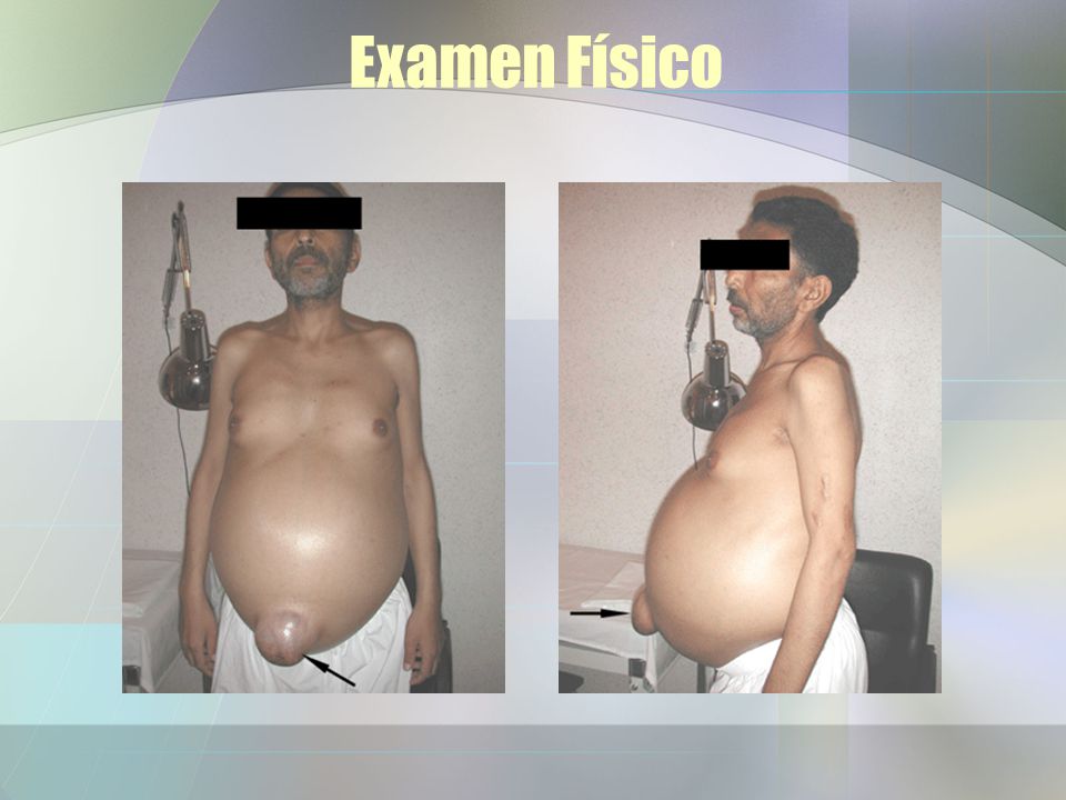 Examen Físico