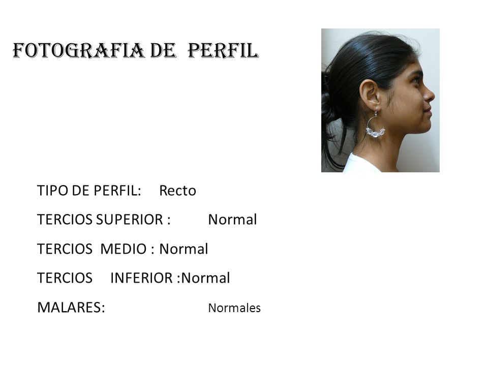 FOTOGRAFIA DE PERFIL TIPO DE PERFIL: Recto TERCIOS SUPERIOR : Normal
