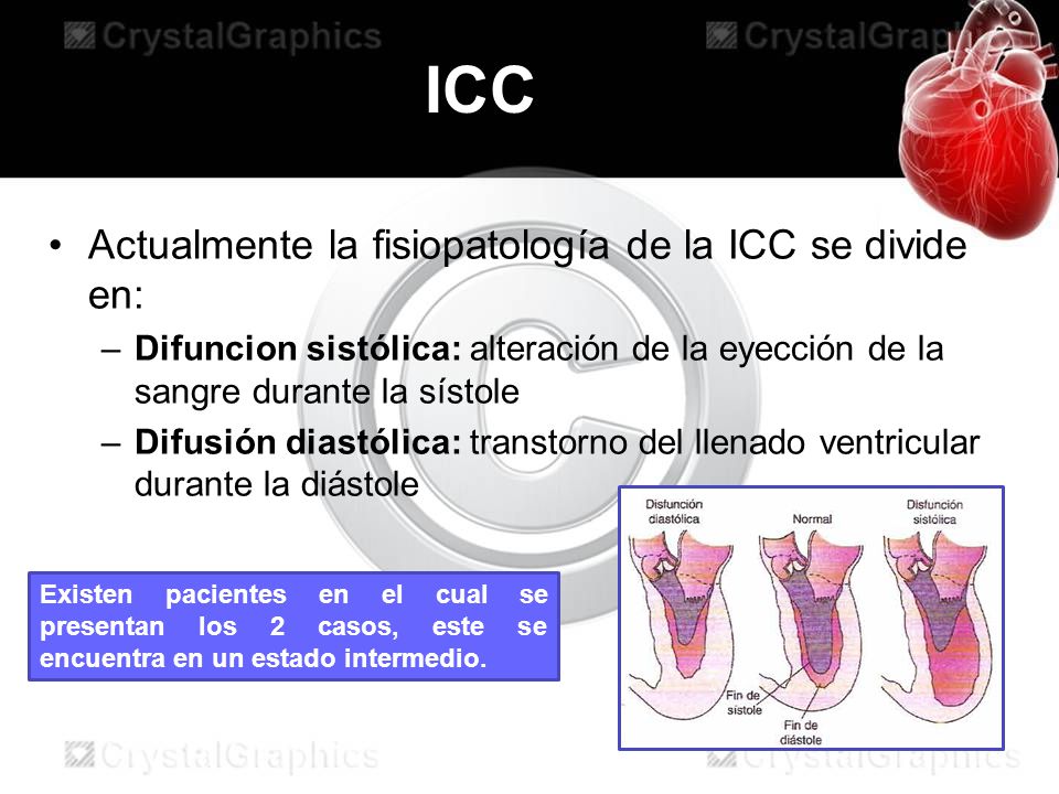 ICC Actualmente la fisiopatología de la ICC se divide en: