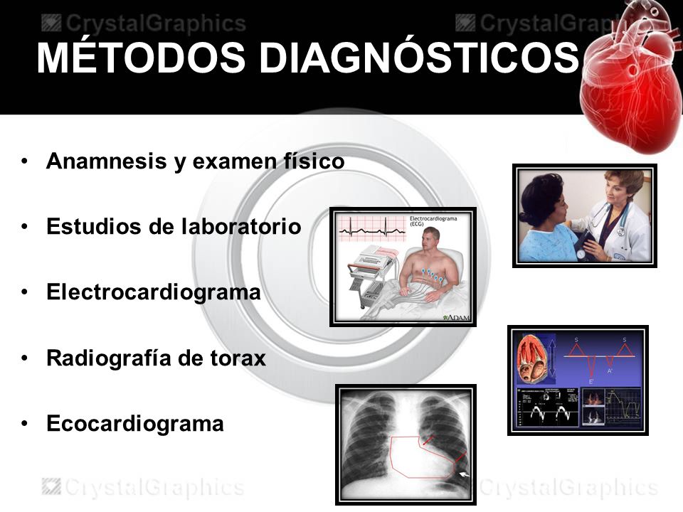 MÉTODOS DIAGNÓSTICOS Anamnesis y examen físico Estudios de laboratorio
