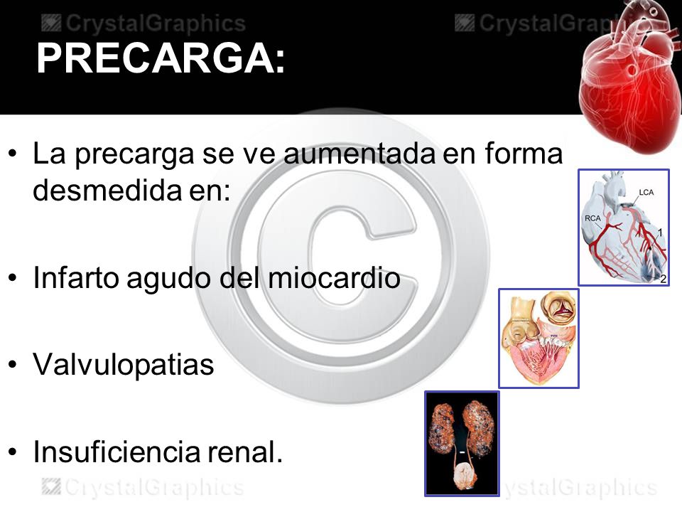 PRECARGA: La precarga se ve aumentada en forma desmedida en: