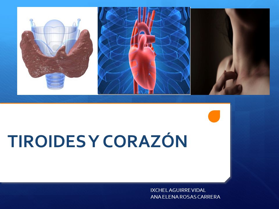 TIROIDES Y CORAZÓN IXCHEL AGUIRRE VIDAL ANA ELENA ROSAS CARRERA