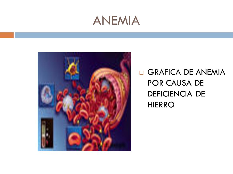 ANEMIA GRAFICA DE ANEMIA POR CAUSA DE DEFICIENCIA DE HIERRO