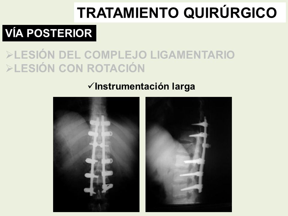 TRATAMIENTO QUIRÚRGICO