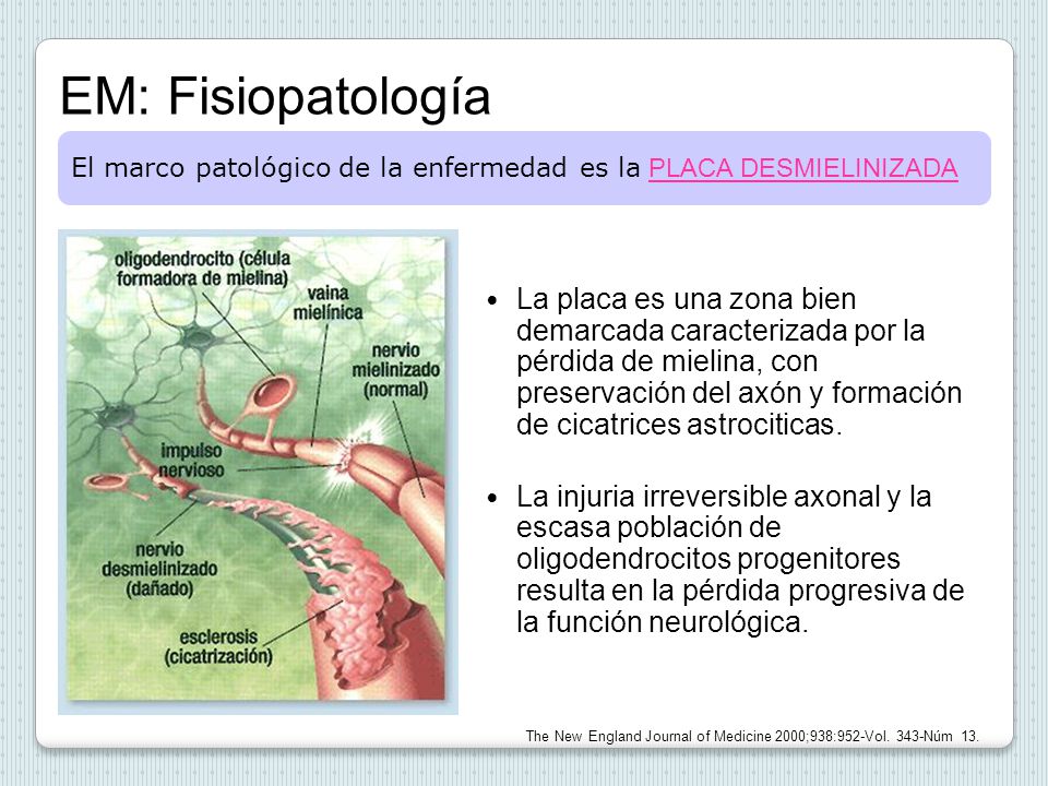 EM: Fisiopatología El marco patológico de la enfermedad es la PLACA DESMIELINIZADA.