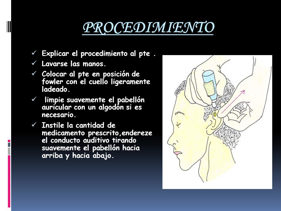 PROCEDIMIENTO Explicar el procedimiento al pte . Lavarse las manos.