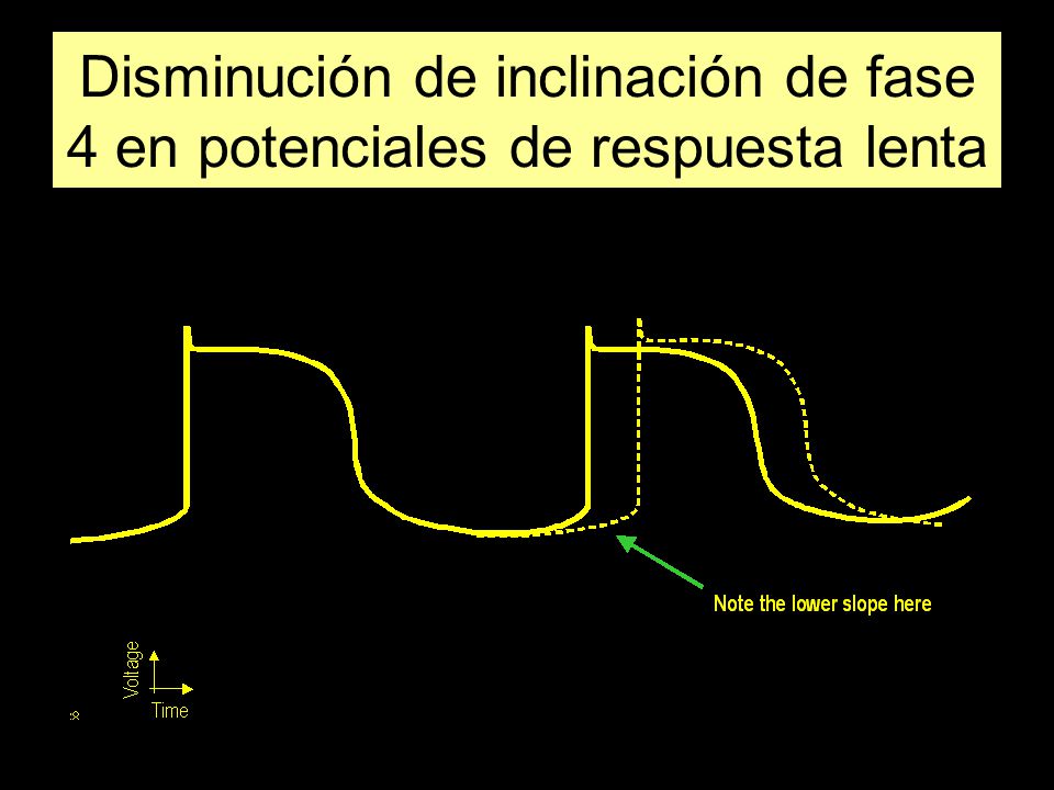 Disminución de inclinación de fase 4 en potenciales de respuesta lenta