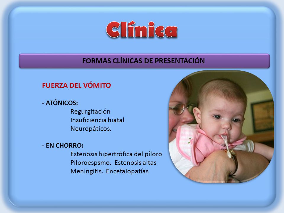 Clínica FORMAS CLÍNICAS DE PRESENTACIÓN FUERZA DEL VÓMITO - ATÓNICOS: