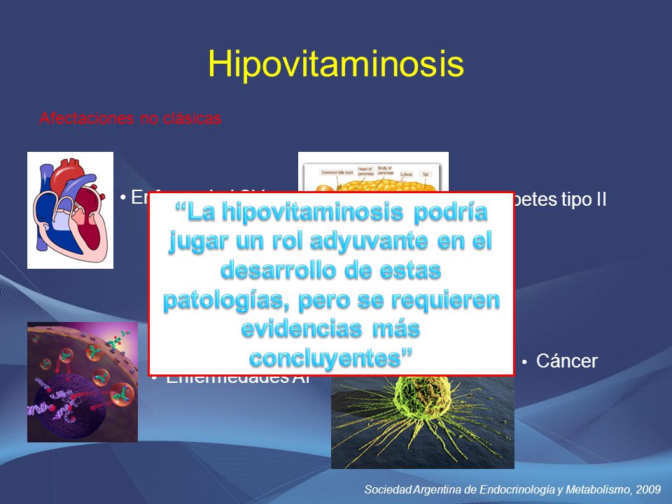 Hipovitaminosis Afectaciones no clásicas. Enfermedad CV. Diabetes tipo II.
