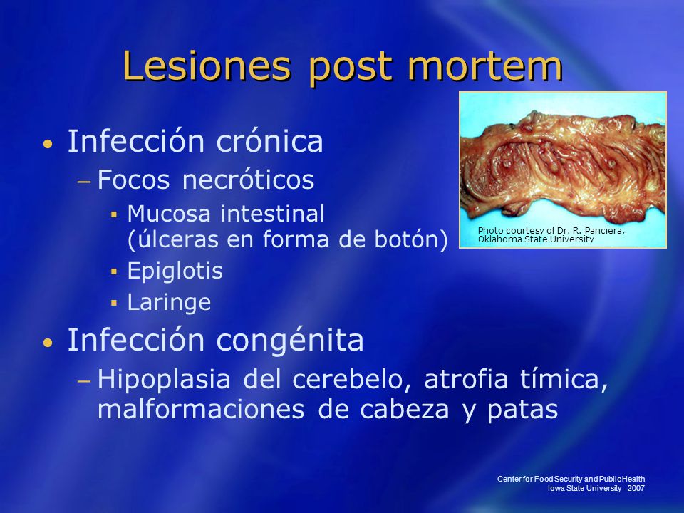 Lesiones post mortem Infección crónica Infección congénita