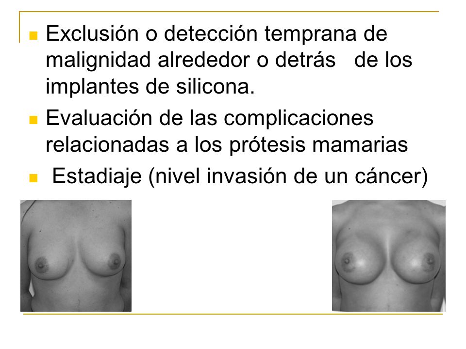Exclusión o detección temprana de malignidad alrededor o detrás