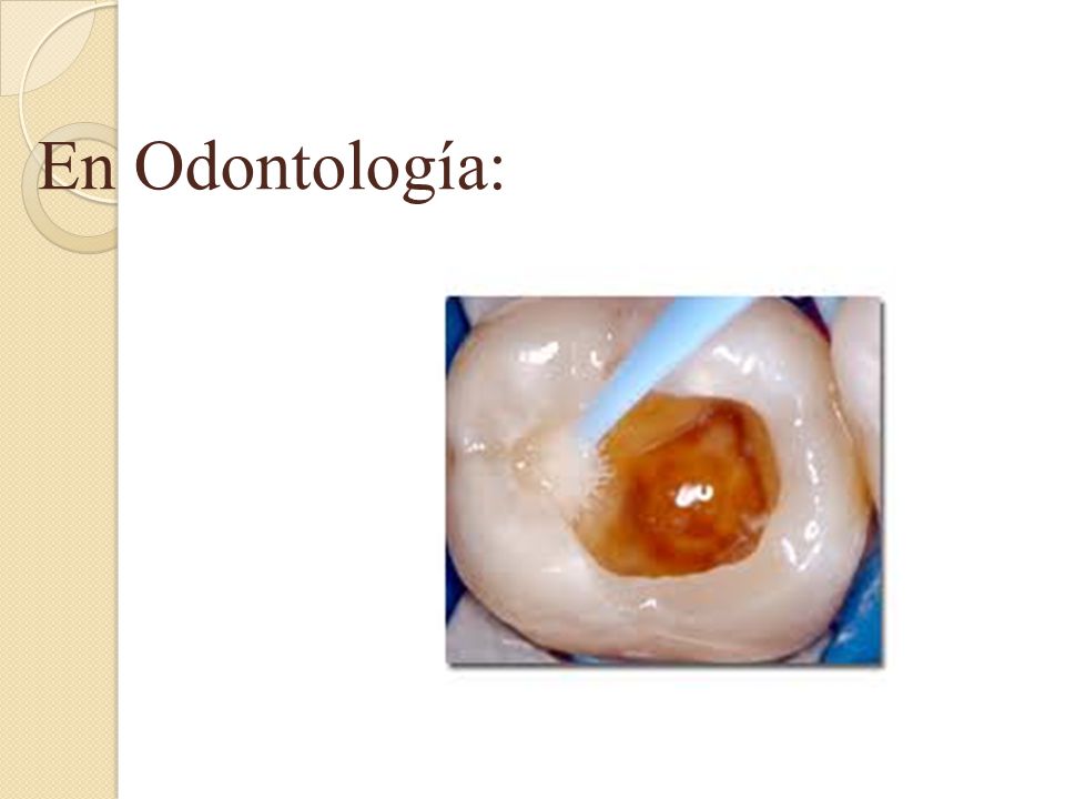 En Odontología: Fundamental importancia en la resolución de filtraciones alrededor de materiales dentales de restauración.