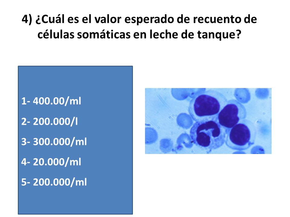 4) ¿Cuál es el valor esperado de recuento de células somáticas en leche de tanque