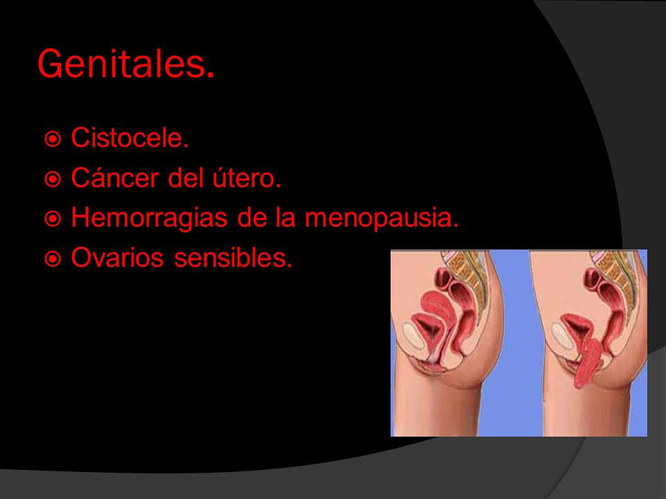Genitales. Cistocele. Cáncer del útero. Hemorragias de la menopausia.