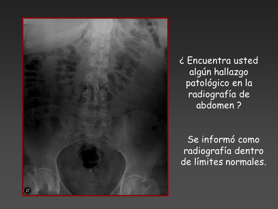 Se informó como radiografía dentro de límites normales.