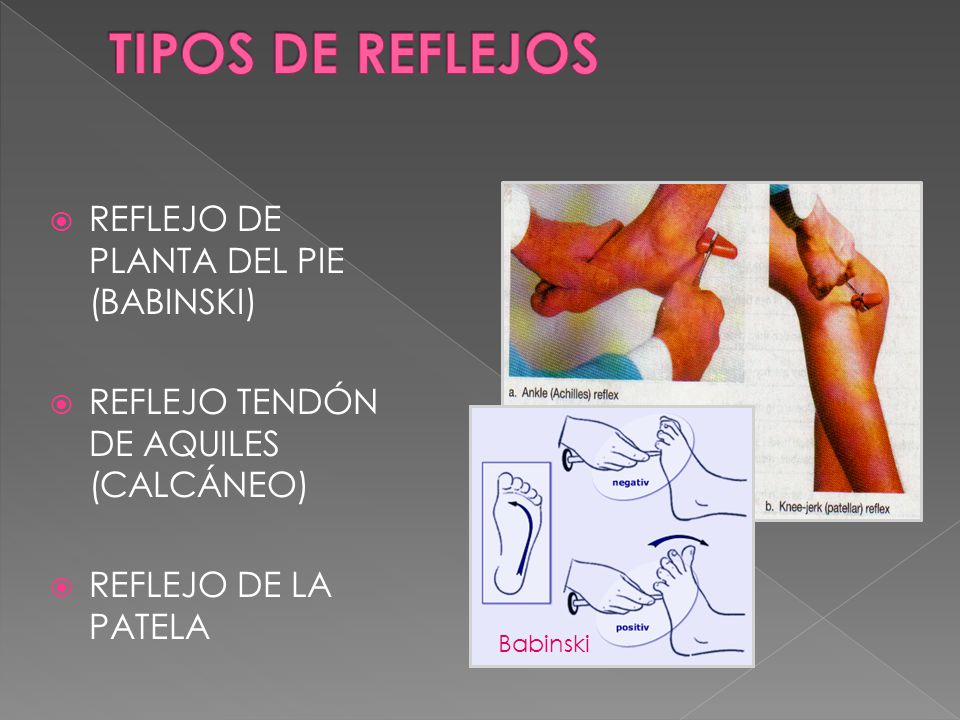 TIPOS DE REFLEJOS REFLEJO DE PLANTA DEL PIE (BABINSKI)