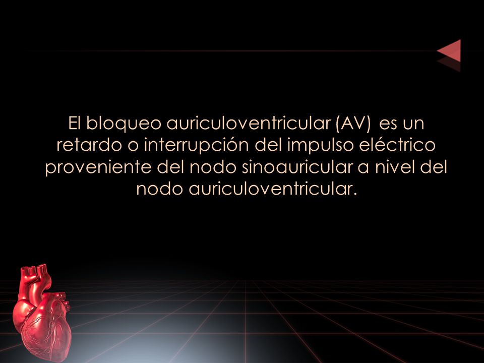El bloqueo auriculoventricular (AV) es un retardo o interrupción del impulso eléctrico proveniente del nodo sinoauricular a nivel del nodo auriculoventricular.