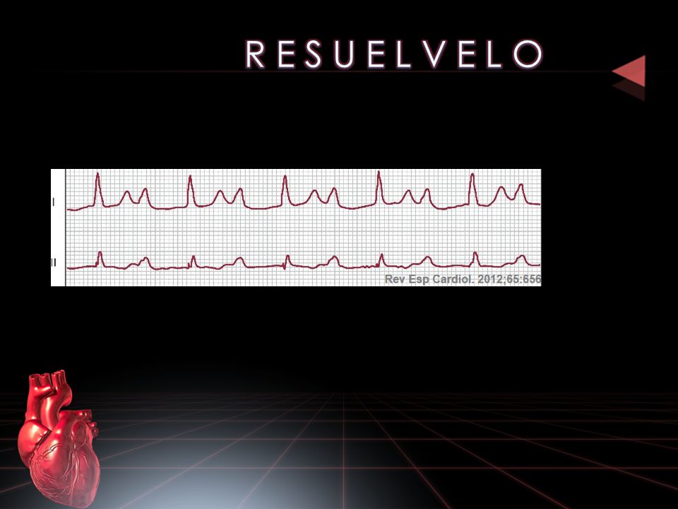 R E S U E L V E L O