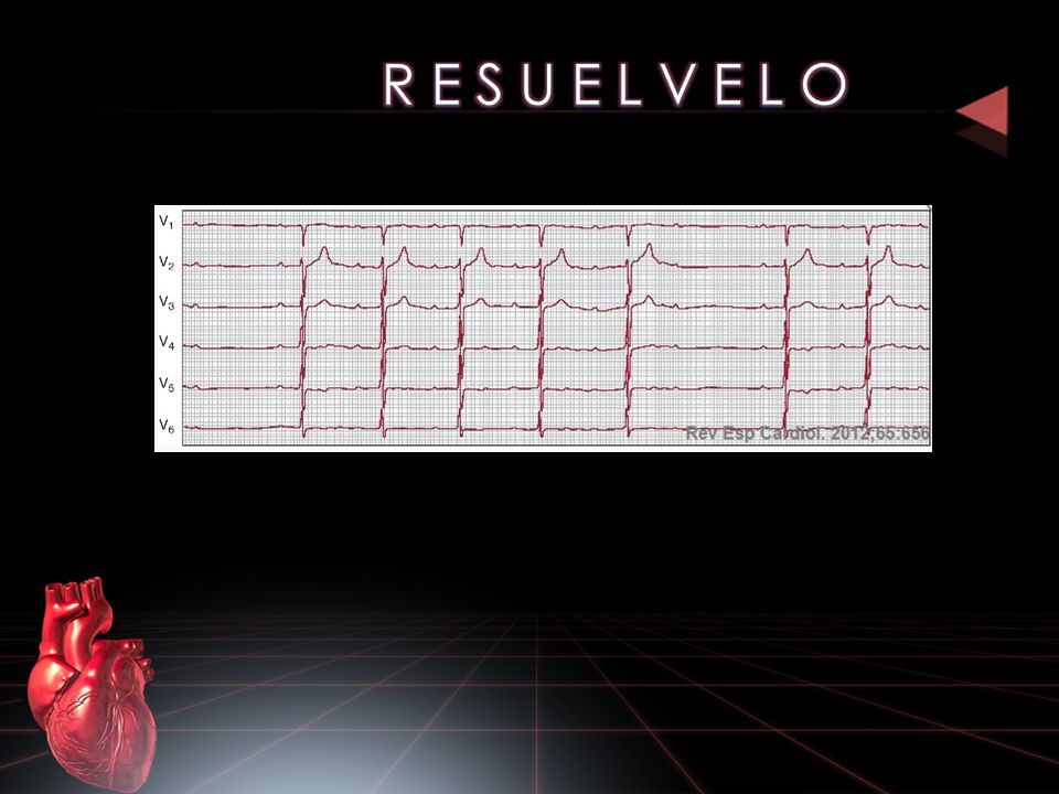 R E S U E L V E L O