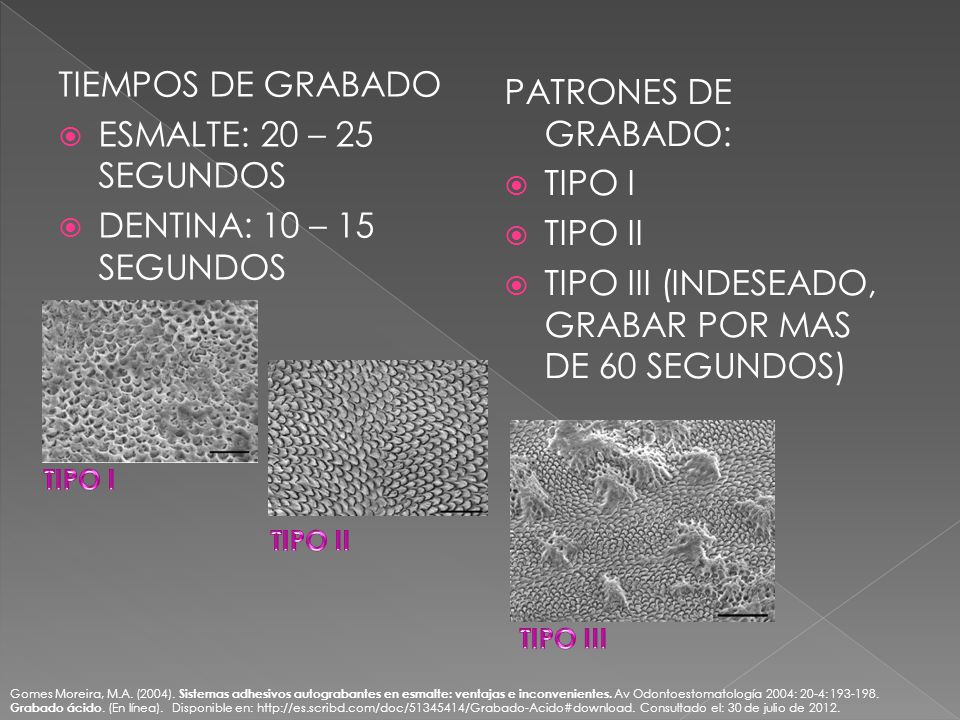 TIPO III (INDESEADO, GRABAR POR MAS DE 60 SEGUNDOS)