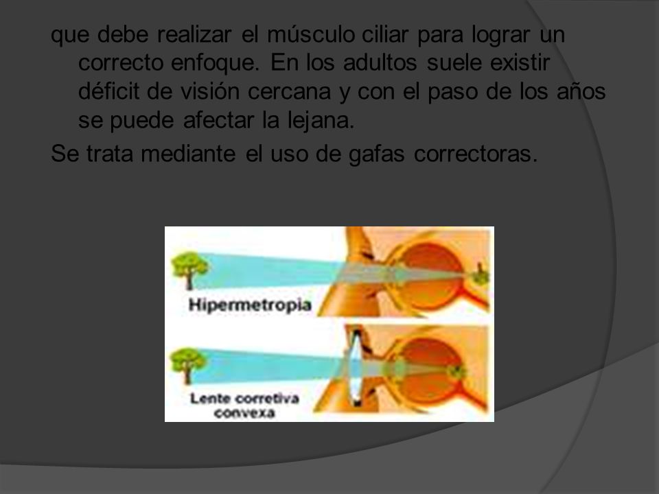 que debe realizar el músculo ciliar para lograr un correcto enfoque